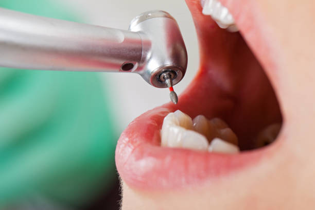 Best Mobile Emergency Dentist in Pomona, CA